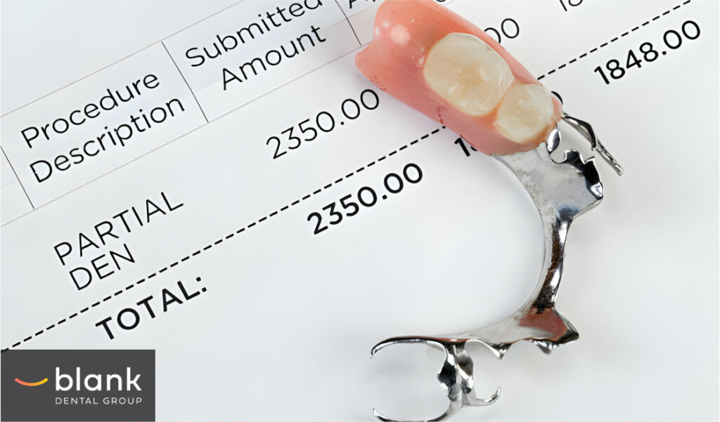 How Much Do Dentures Cost in Ohio? What You Need to Know