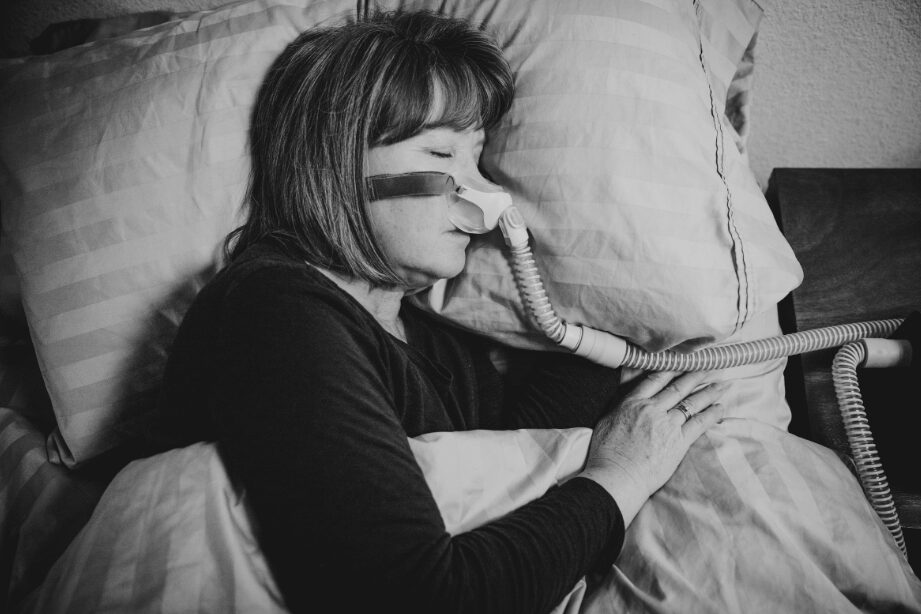 Woman sleeping showing signs of sleep apnea
